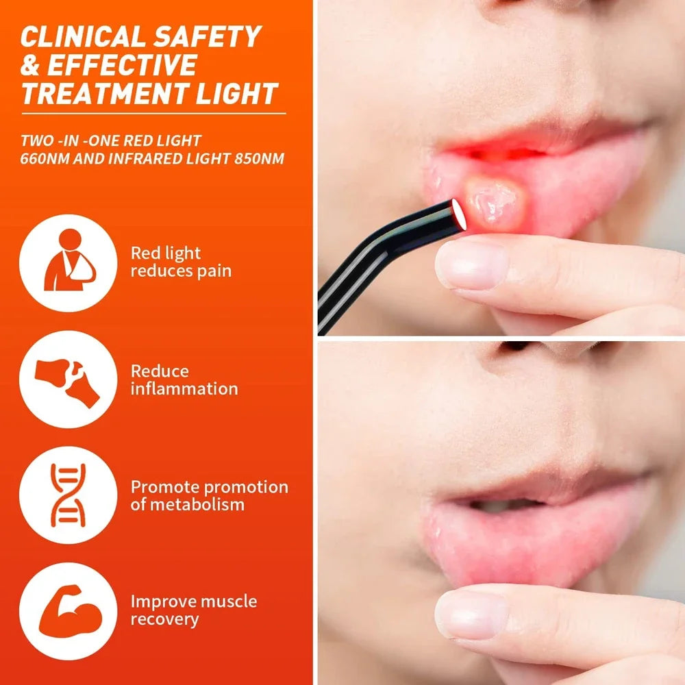 PAQIN Infrared Red Light Therapy Lamp Cold Sore Treatment