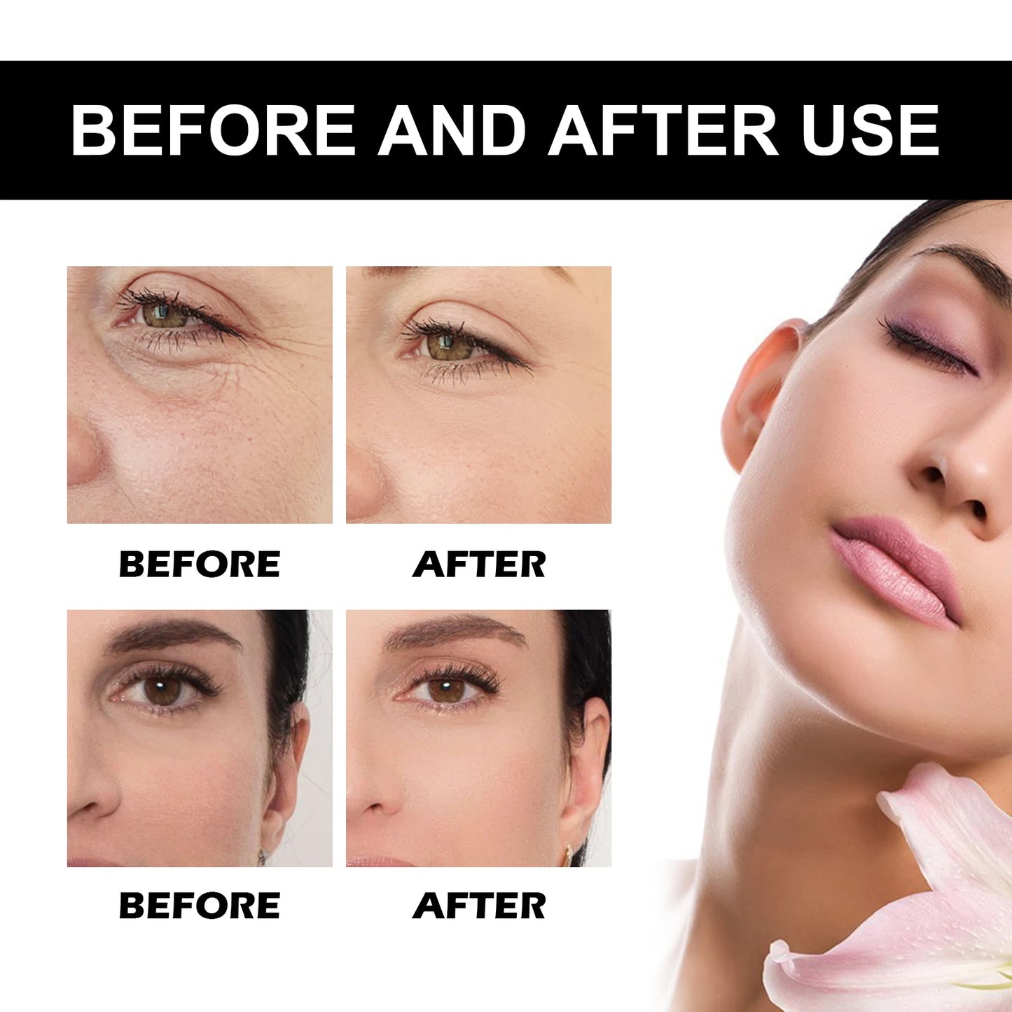 Eelhoe Vitamin C Serum For Face Dark Spot Removal Niacinamide