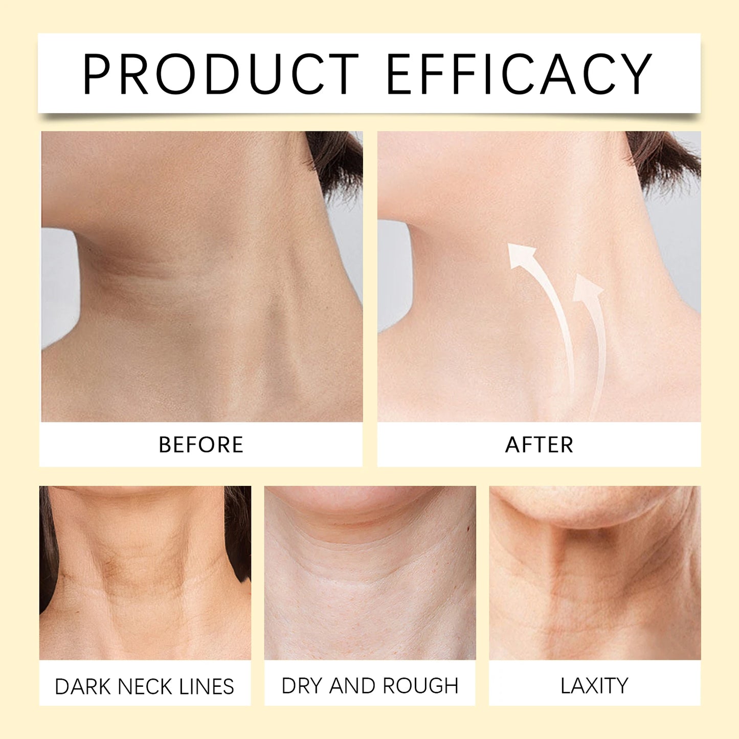 Eelhoe Bee Venom Cream Stick Firming Skin Care Moisturizing Neck
