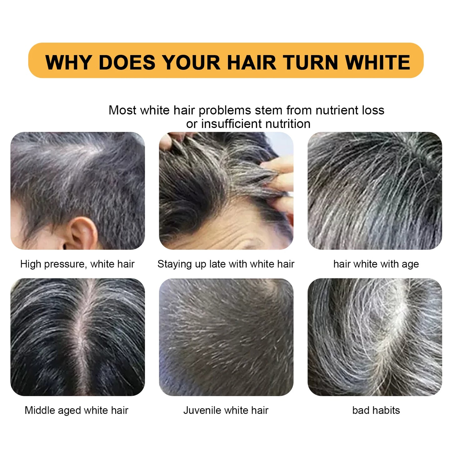 Polygonum Multiflorum Hair Shampoo Soap For Darkening And Scalp