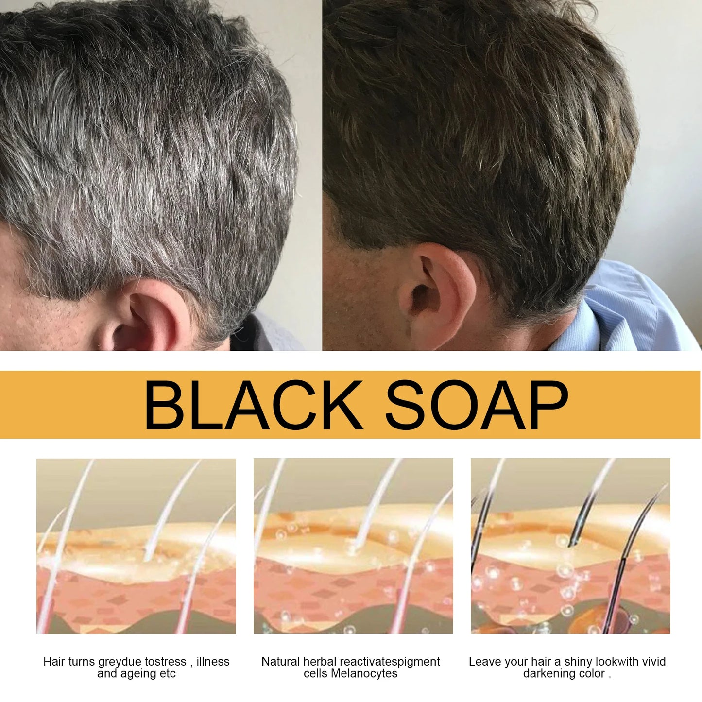 Polygonum Multiflorum Hair Shampoo Soap For Darkening And Scalp
