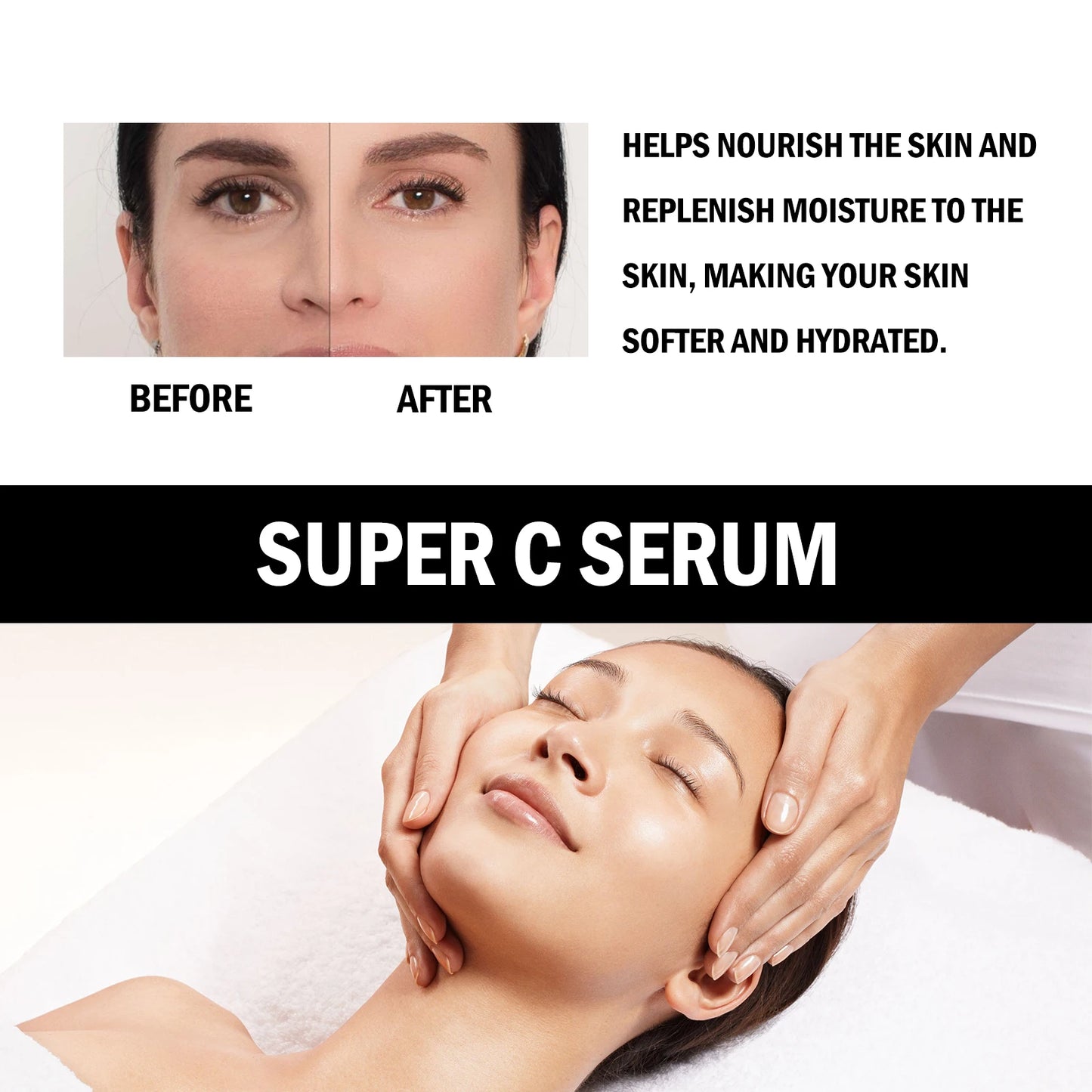 Eelhoe Vitamin C Serum For Face Dark Spot Removal Niacinamide