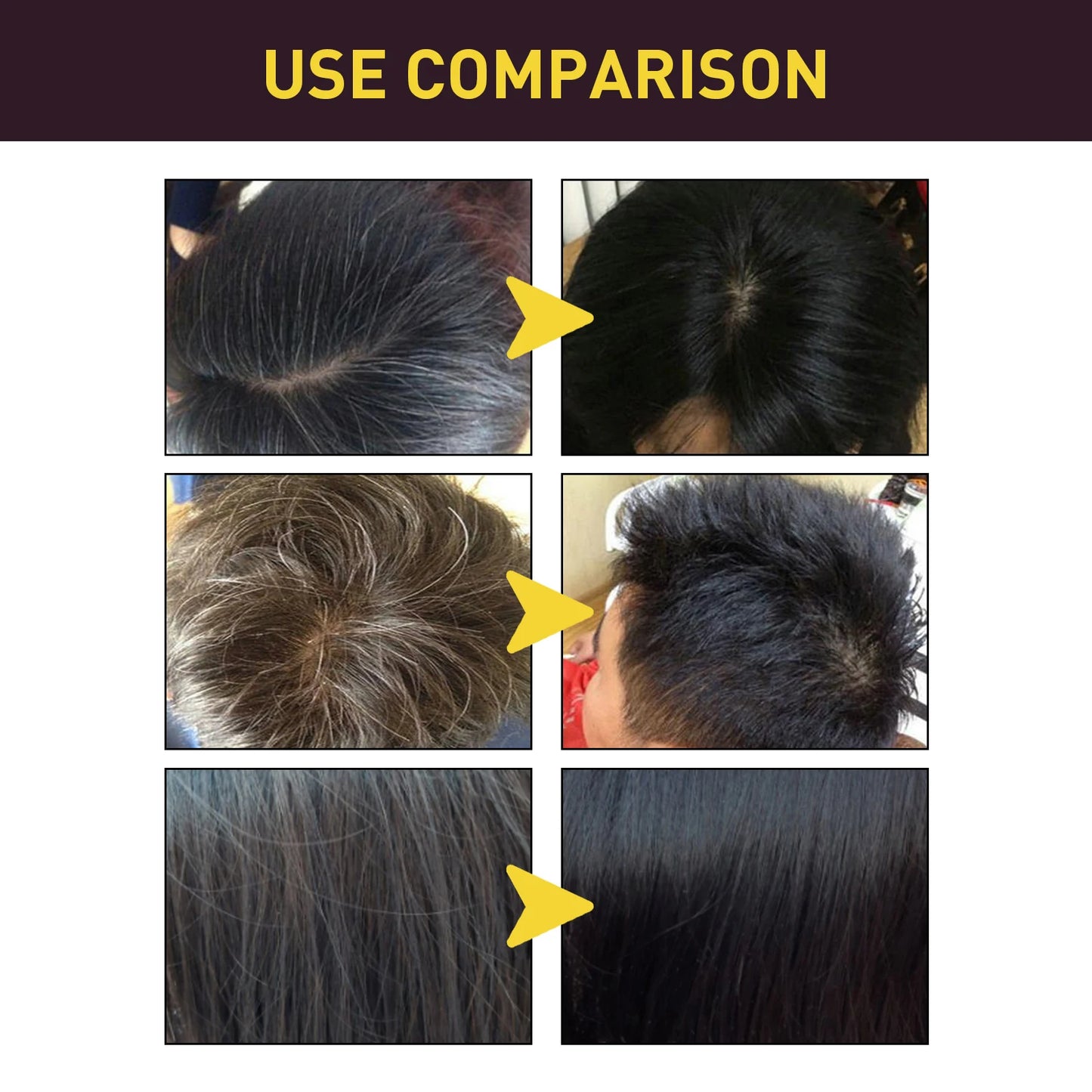 Eelhoe Hair Darkening Shampoo With Polygonum Ginger For Grey Hair